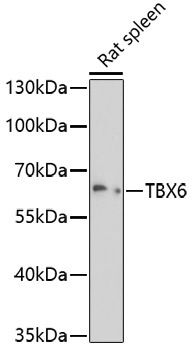 Western blot - TBX6 Polyclonal Antibody 