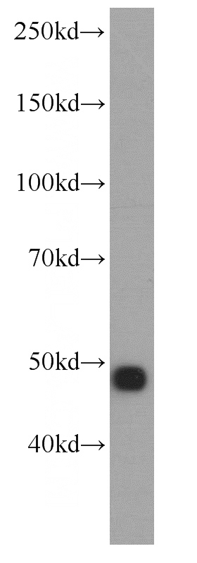 human brain tissue were subjected to SDS PAGE followed by western blot with Catalog No:113288(ENO2 antibody) at dilution of 1:400