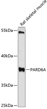 Western blot - PARD6A Polyclonal Antibody 