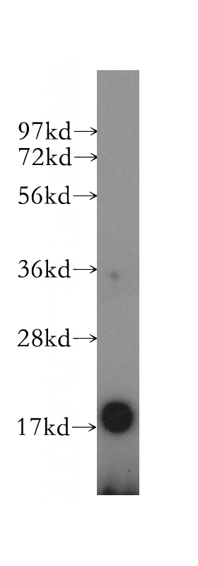 SGC-7901 cells were subjected to SDS PAGE followed by western blot with Catalog No:114683(REG4 antibody) at dilution of 1:300