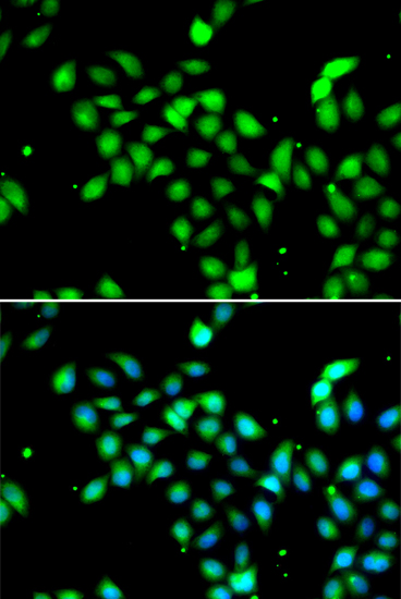 Immunofluorescence - METTL13 Polyclonal Antibody 