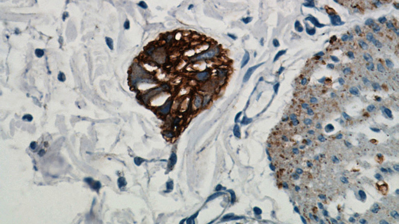 Immunohistochemical of paraffin-embedded human colon using Catalog No:113027(NCAM1 antibody) at dilution of 1:50 (under 40x lens)