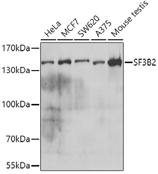 Western blot - SF3B2 Polyclonal Antibody 