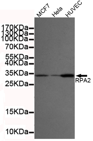 Western blot detection of RPA32/RPA2 in MCF7,Hela and HUVEC cell lysates using RPA32/RPA2 mouse mAb (1:2000 diluted).Predicted band size:32KDa.Observed band size:32KDa.Exposure time:20s.