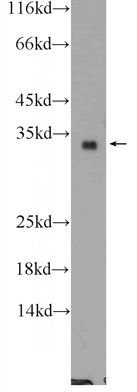 MCF-7 cells were subjected to SDS PAGE followed by western blot with Catalog No:110633(FGF17 Antibody) at dilution of 1:600