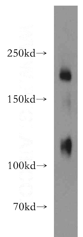 human placenta tissue were subjected to SDS PAGE followed by western blot with Catalog No:113182(NID2 antibody) at dilution of 1:2000