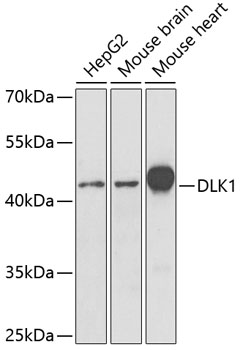 Western blot - DLK1 Polyclonal Antibody 