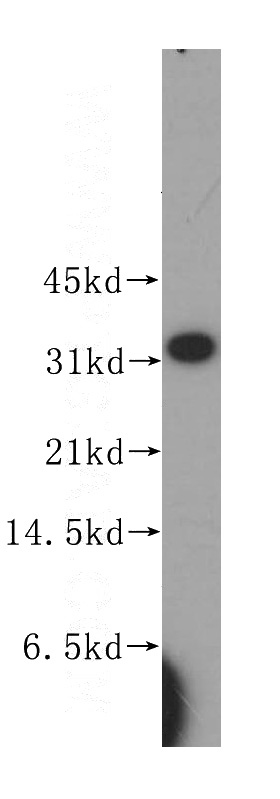 human liver tissue were subjected to SDS PAGE followed by western blot with Catalog No:111498(HNMT antibody) at dilution of 1:400