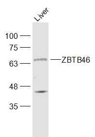 Fig1: Sample:; Liver (Mouse) Lysate at 40 ug; Primary: Anti-ZBTB46 at 1/1000 dilution; Secondary: IRDye800CW Goat Anti-Rabbit IgG at 1/20000 dilution; Predicted band size: 64 kD; Observed band size: 64 kD