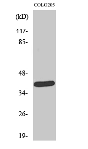 Fig1:; Western Blot analysis of various cells using NEGR1 Polyclonal Antibody