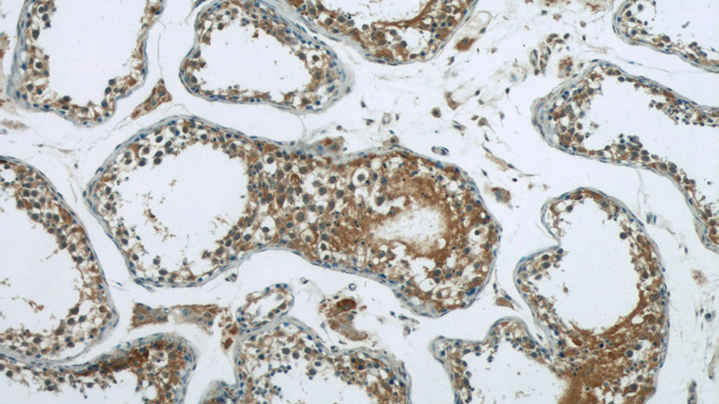 Immunohistochemistry of paraffin-embedded human testis tissue slide using Catalog No:108783(C6orf204 Antibody) at dilution of 1:50 (under 10x lens)
