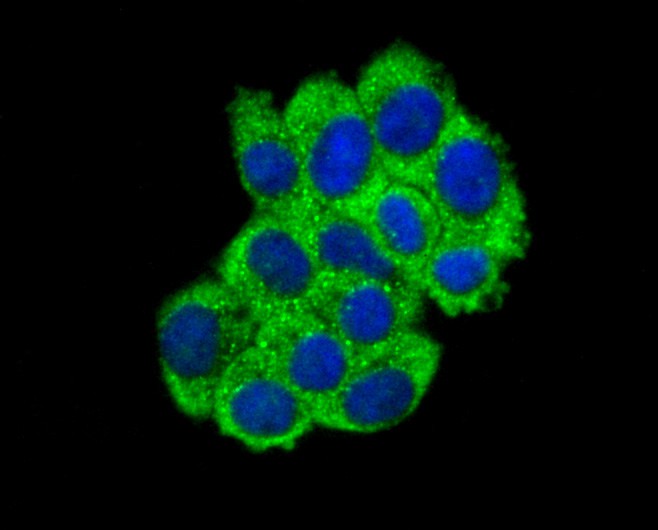 Fig2: ICC staining ABCF1 in HepG2 cells (green). The nuclear counter stain is DAPI (blue). Cells were fixed in paraformaldehyde, permeabilised with 0.25% Triton X100/PBS.