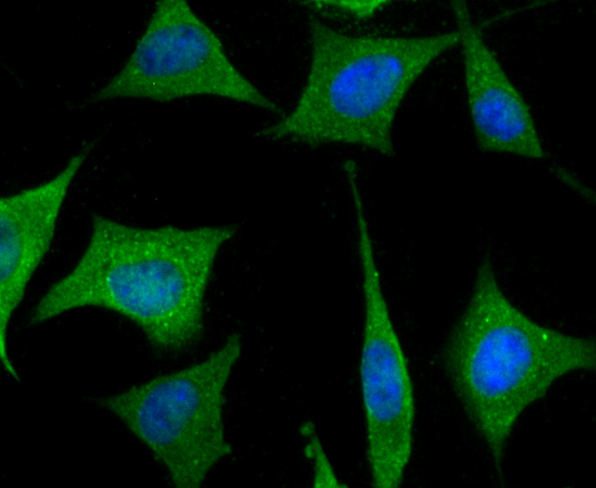 Fig5: ICC staining PRTN3 in SH-SY5Y cells (green). The nuclear counter stain is DAPI (blue). Cells were fixed in paraformaldehyde, permeabilised with 0.25% Triton X100/PBS.
