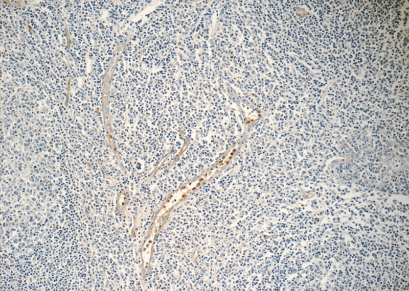 Immunohistochemistry of paraffin-embedded human tonsillitis tissue slide using Catalog No:113140(NFAM1 Antibody) at dilution of 1:50 (under 10x lens)