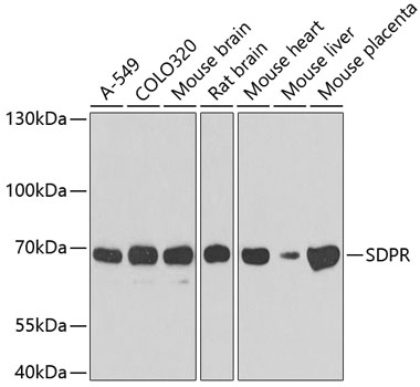 Western blot - SDPR Polyclonal Antibody 