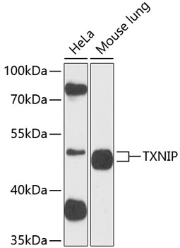 Western blot - TXNIP Polyclonal Antibody 
