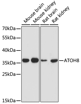 Western blot - ATOH8 Polyclonal Antibody 