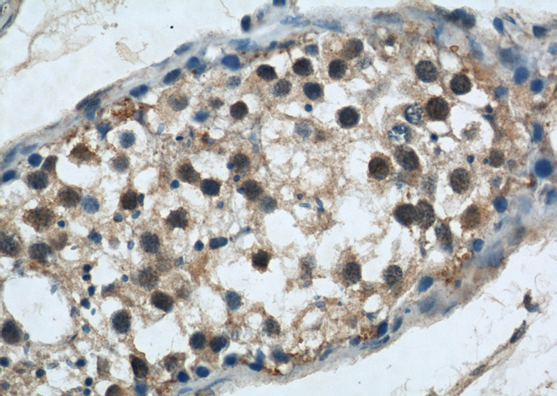Immunohistochemical of paraffin-embedded human testis using Catalog No:111169(GSK3B antibody) at dilution of 1:50 (under 40x lens)