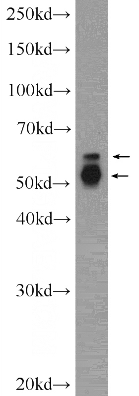 mouse brain tissue were subjected to SDS PAGE followed by western blot with Catalog No:113489(PAG1 Antibody) at dilution of 1:1000