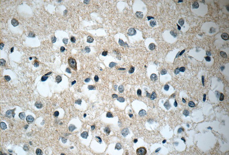 Immunohistochemistry of paraffin-embedded human brain tissue slide using Catalog No:115767(SYNJ2 Antibody) at dilution of 1:50 (under 40x lens)