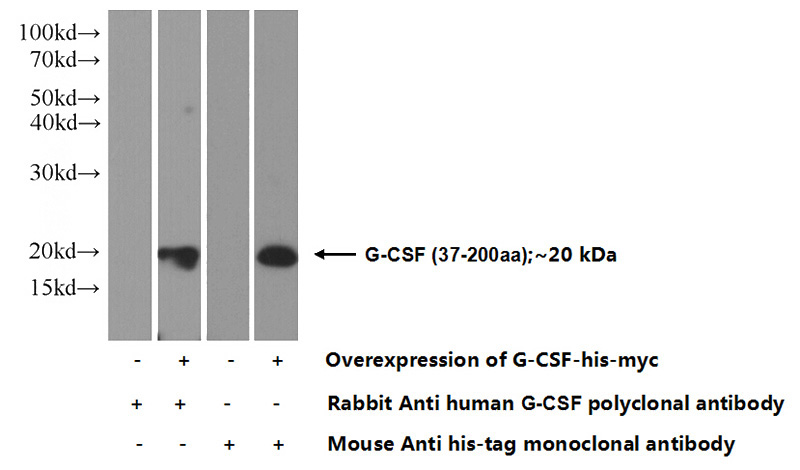 Transfected HEK-293 cells were subjected to SDS PAGE followed by western blot with Catalog No:110916(G-CSF Antibody) at dilution of 1:1000