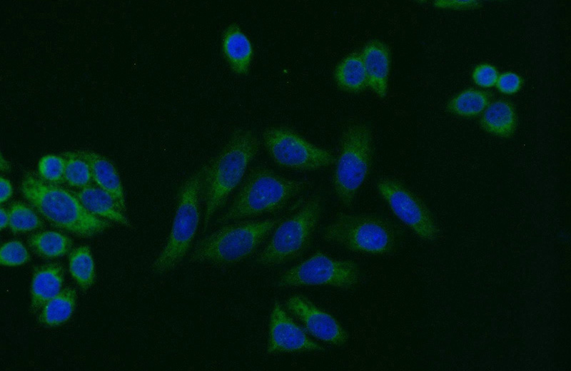 Immunofluorescent analysis of HeLa cells using Catalog No:114197(PRKAR2A Antibody) at dilution of 1:25 and Alexa Fluor 488-congugated AffiniPure Goat Anti-Rabbit IgG(H+L)
