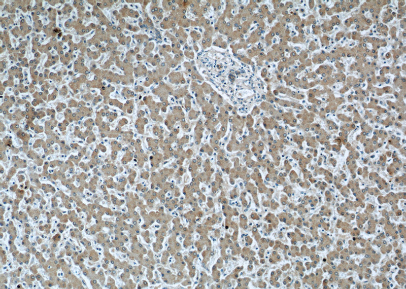 Immunohistochemistry of paraffin-embedded human liver tissue slide using Catalog No:107027(C3 Antibody) at dilution of 1:50 (under 10x lens)