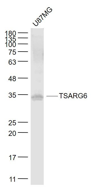 Fig2: Sample:; U87MG(Human) Cell Lysate at 30 ug; Primary: Anti- TSARG6 at 1/1000 dilution; Secondary: IRDye800CW Goat Anti-Rabbit IgG at 1/20000 dilution; Predicted band size: 36 kD; Observed band size: 35 kD