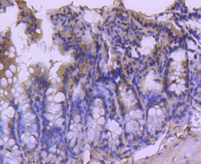 Fig6: Immunohistochemical analysis of paraffin-embedded mouse colon tissue using anti-CDC40 antibody. Counter stained with hematoxylin.