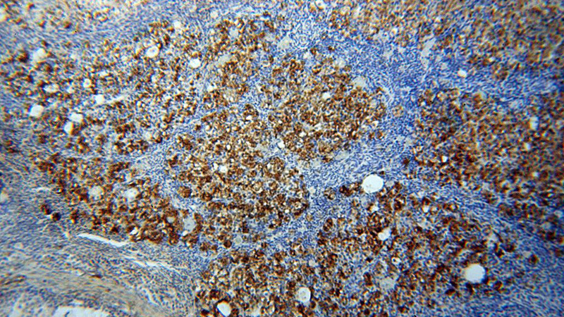 Immunohistochemical of paraffin-embedded human ovary using Catalog No:114355(PYCR2 antibody) at dilution of 1:50 (under 10x lens)