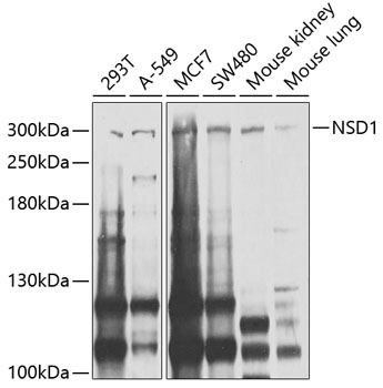 Western blot - NSD1 Polyclonal Antibody 