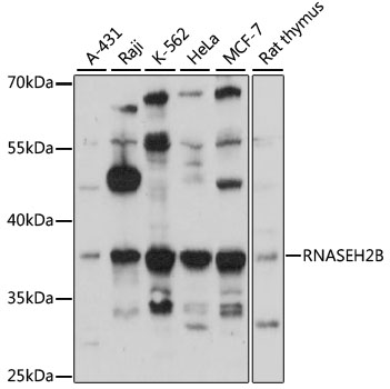 Western blot - RNASEH2B Polyclonal Antibody 