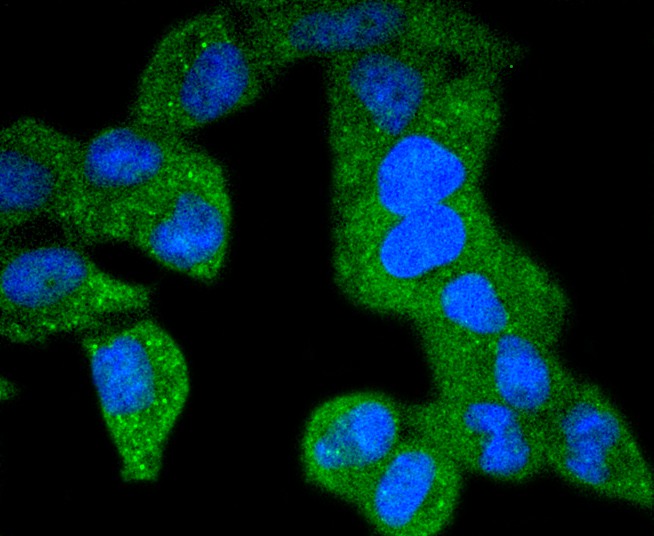 Fig2: ICC staining PDGF Receptor beta(phospho Y740) in Hela cells (green). The nuclear counter stain is DAPI (blue). Cells were fixed in paraformaldehyde, permeabilised with 0.25% Triton X100/PBS.
