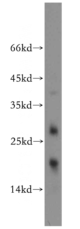 mouse brain tissue were subjected to SDS PAGE followed by western blot with Catalog No:116213(TPPP2 antibody) at dilution of 1:100