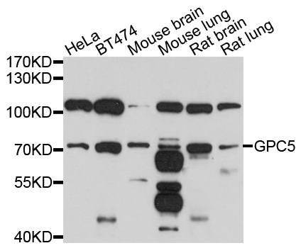 Western blot - GPC5 Polyclonal Antibody 