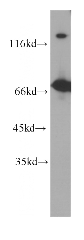 Jurkat cells were subjected to SDS PAGE followed by western blot with Catalog No:107547(ZAP70 antibody) at dilution of 1:1000