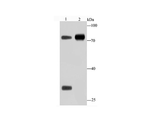 Fig1:; Western blot analysis of human IgM on Human plasma (1) and Raji (2) lysate using anti-Human IgM antibody at 1/1,000 dilution.