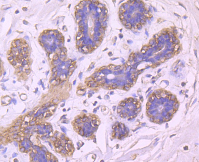 Fig3: Immunohistochemical analysis of paraffin-embedded human breast tissue using anti-BLCAP antibody. Counter stained with hematoxylin.