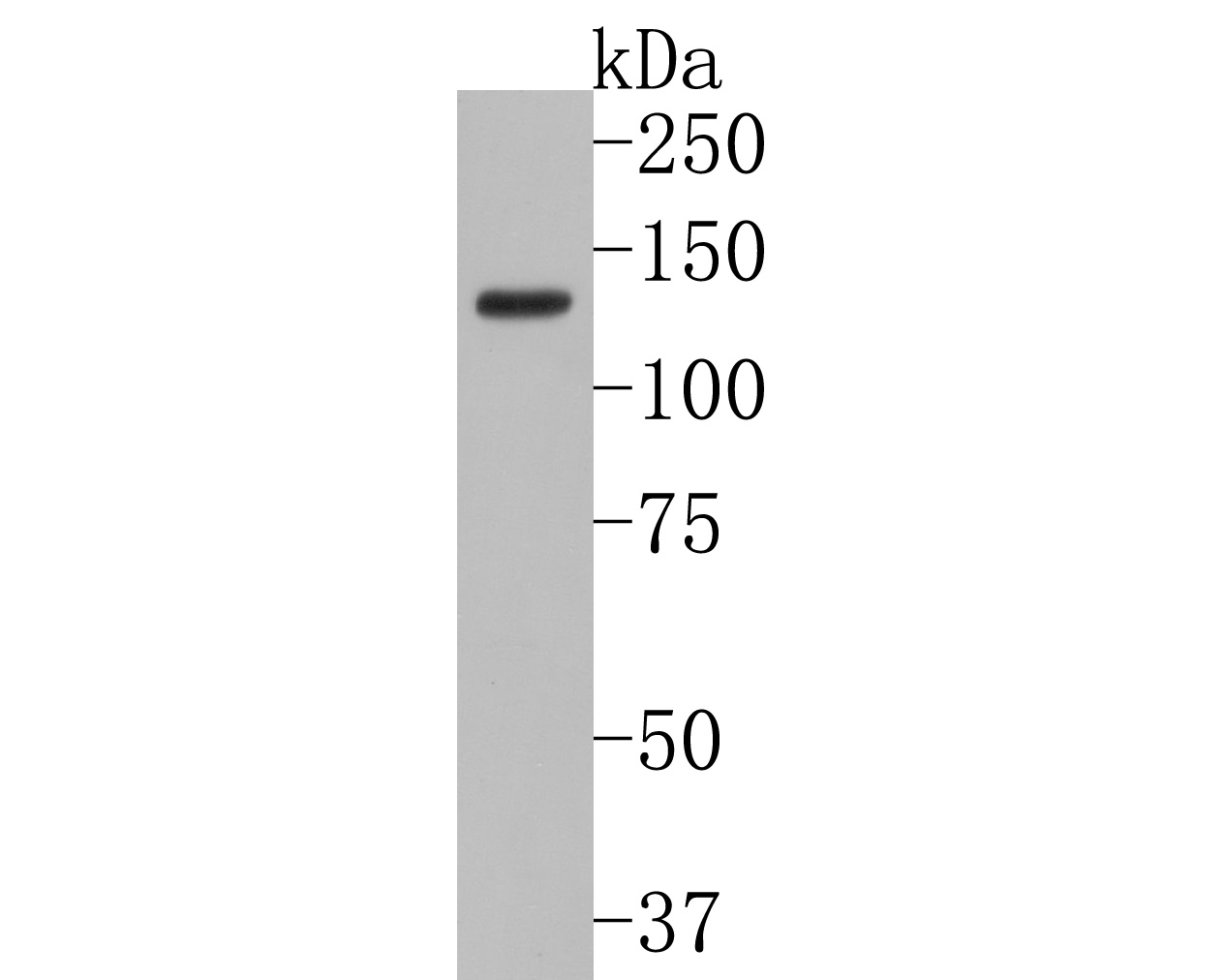 Fig2:; Western blot analysis of Leptin Receptor on HepG2 cell lysates. Proteins were transferred to a PVDF membrane and blocked with 5% BSA in PBS for 1 hour at room temperature. The primary antibody ( 1/500) was used in 5% BSA at room temperature for 2 hours. Goat Anti-Rabbit IgG - HRP Secondary Antibody (HA1001) at 1:200,000 dilution was used for 1 hour at room temperature.