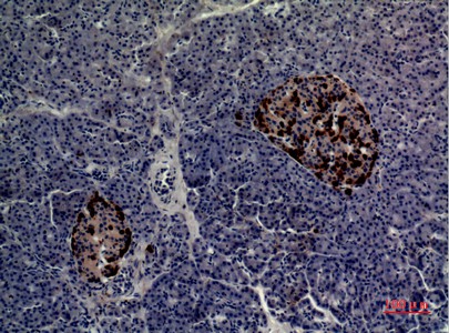 Fig2:; Immunohistochemical analysis of paraffin-embedded human-pancreas, antibody was diluted at 1:100
