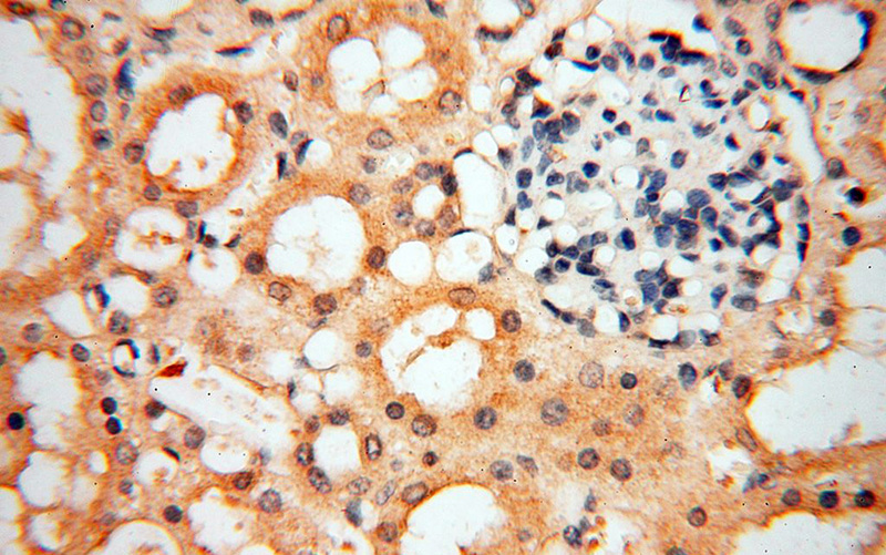 Immunohistochemical of paraffin-embedded human kidney using Catalog No:115401(SMPX antibody) at dilution of 1:50 (under 40x lens)