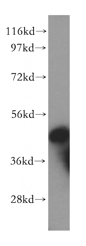 HeLa cells were subjected to SDS PAGE followed by western blot with Catalog No:111067(GPN1 antibody) at dilution of 1:500