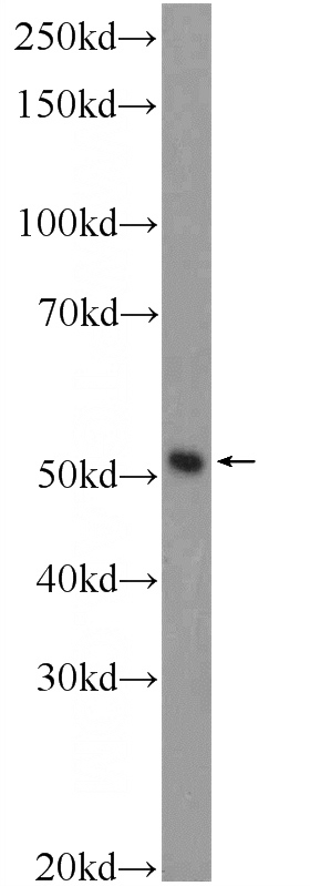 PC-3 cells were subjected to SDS PAGE followed by western blot with Catalog No:108602(C15orf58 Antibody) at dilution of 1:300