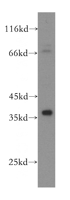 PC-3 cells were subjected to SDS PAGE followed by western blot with Catalog No:112091(KLHL14 antibody) at dilution of 1:1000
