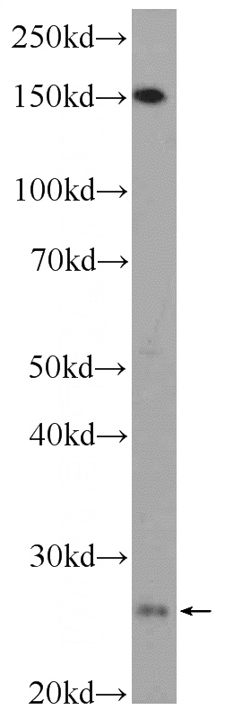COLO 320 cells were subjected to SDS PAGE followed by western blot with Catalog No:108614(C18orf21 Antibody) at dilution of 1:600