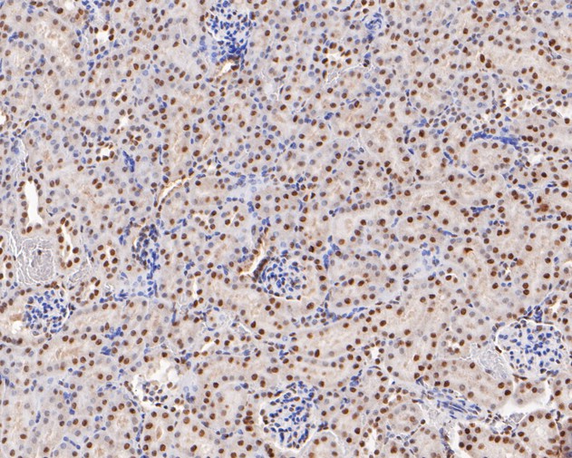 Fig11:; Immunohistochemical analysis of paraffin-embedded mouse stomach tissue using anti-GATAD2A antibody. The section was pre-treated using heat mediated antigen retrieval with sodium citrate buffer (pH 6.0) for 20 minutes. The tissues were blocked in 5% BSA for 30 minutes at room temperature, washed with ddH; 2; O and PBS, and then probed with the primary antibody ( 1/200) for 30 minutes at room temperature. The detection was performed using an HRP conjugated compact polymer system. DAB was used as the chromogen. Tissues were counterstained with hematoxylin and mounted with DPX.