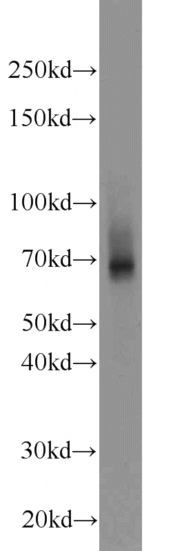 DU 145 cells were subjected to SDS PAGE followed by western blot with Catalog No:117166(ZNF354A antibody) at dilution of 1:1000