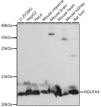 Western blot - NDUFA4 Polyclonal Antibody 