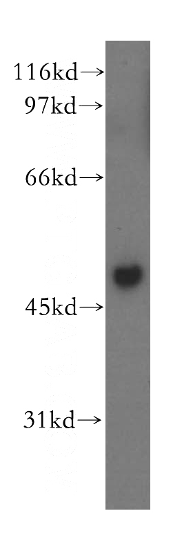 human stomach tissue were subjected to SDS PAGE followed by western blot with Catalog No:112880(YBX2 antibody) at dilution of 1:500