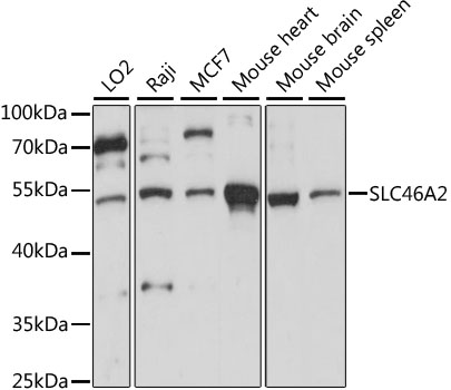 Western blot - SLC46A2 Polyclonal Antibody 